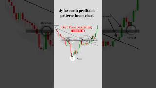 Profitable patternsTradingwithdigitgurus education chartpatterns trading tradingtips shorts [upl. by Vic]