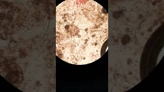 sarcoptic scabiei  sarcoptic mange canine scabies under microscope [upl. by Teddie824]