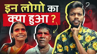 Kaccha Badam amp Ranu Mandal ये लोग का क्या हुआ [upl. by Pollard]