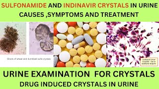 SULFONAMIDE AND INDINAVIR CRYSTALS IN URINECAUSES SYMPTOMS AND TREATMENT OF SULFONAMIDE CRYSTALS [upl. by Aeslehs806]