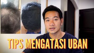 MENGATASI RAMBUT BOTAK DAN UBAN pejuangganteng [upl. by Fe]