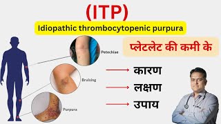 ITP बीमारी क्या है । प्लेटलेट की कम रहने का कारण । Thrombocytopenia symptoms and treatment । [upl. by Lyndsie531]