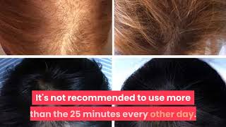 What happen if I use iRestore Laser Hair Growth System everyday and more than 25 min [upl. by Merri771]