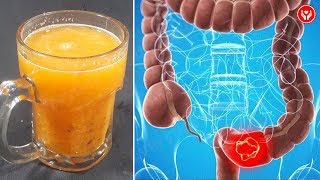 This Natural Drink Will Remove All The Waste From Your Colon [upl. by Tnomyar]