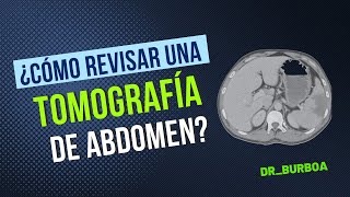 TOMOGRAFÍA DE ABDOMEN  ¿CÓMO REVISARLA [upl. by Adiaj127]