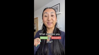 What pimples you SHOULD and SHOULDN’T pop [upl. by Nyllek]