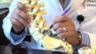 Surgical Procedures  Lumbar Laminectomy amp Discectomy [upl. by Kelula]