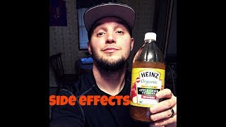 Most Common Apple Cider Vinegar Side Effects [upl. by Marriott]