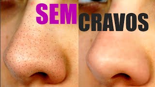 COMO REMOVER CRAVOS DO NARIZ  RECEITA CASEIRA VEDA8 [upl. by Dinny]