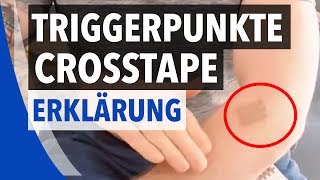 Crosstape  Gittertape Punkte und Anwendung für Triggerpunkte  BodyTape [upl. by Malas110]