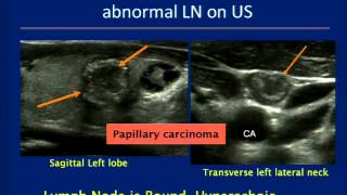 Thyroid Ultrasound Course [upl. by Ycnuahc]