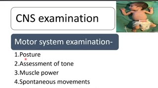 CNS Examination in Newborn  Newborn Examination Part9  Pediatrics [upl. by Anialeh]