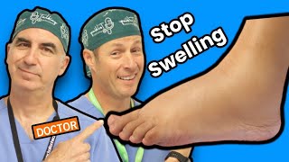 Foot And Ankle Swelling How To Stop It [upl. by Aletse127]