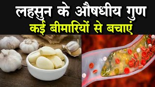 Garlic Health Benefits लहसुन को ऐसे करें डाइट में शामिल दूर भाग जाएगा कोलेस्ट्रॉल जानें फायदे [upl. by Farmelo316]