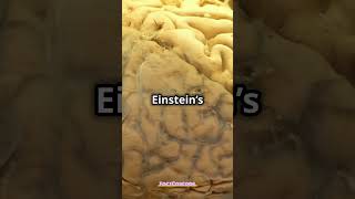 Albert Einstein Brain Was Stolen 🧠🤯 ytshorts alberteinstein [upl. by Cissie]