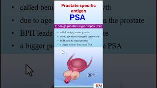 Why is a PSA level elevated psa prostateproblems prostatecancer [upl. by Bolte13]