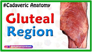 Gluteal region  Cadaveric Anatomy [upl. by Merri]