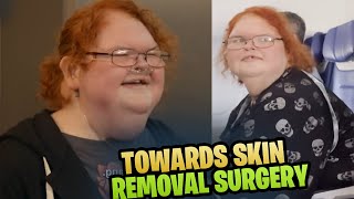 1000lb Sisters Tammy Slatons Journey Preparing for Skin Removal Surgery [upl. by Nnairet]