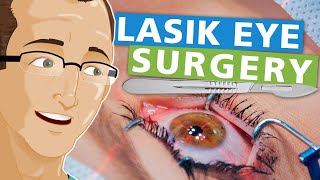 Lasik Eye Surgery [upl. by Rosio]