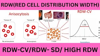 RDWRED CELL DISTRIBUTION WIDTH RDW SDRDW CVNORMAL RANGESHIGH RDWRDW AND ANEAMIA RDW FORMULA [upl. by Keram]