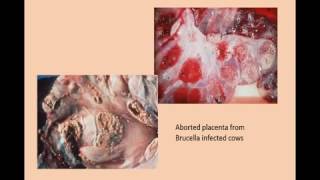 Brucellosis  Brucella [upl. by Cire686]