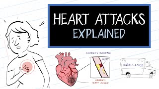 What is a Heart Attack HealthSketch [upl. by Sergent]