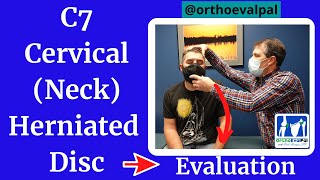 C7 Cervical neck Herniated Disc Evaluation [upl. by Amliv]