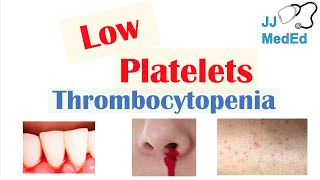 Thrombocytopenia  Signs and Symptoms and Approach to Causes [upl. by Aisats]