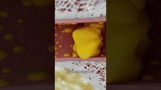 How to Remove Ear Wax Blockage the Right Way shorts facts  creativelearning3d [upl. by Dola]