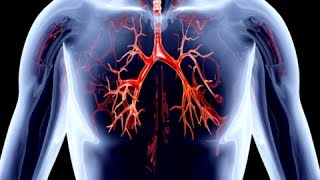 How to Remove Calcium Deposits From Arteries  Clogged Arteries Home Remedies [upl. by Nahgaem872]