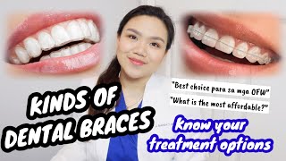 KINDS OF DENTAL BRACES 🦷  WHATS BEST FOR YOU 🤔  Pinoy Dentist  Dr Bianca Beley [upl. by Ylle]