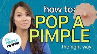 How to Pop a Pimple the RIGHT Way  Dr Pimple Popper  SLMD Skincare [upl. by Ramedlaw979]