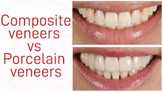 Composite veneers vs Porcelain veneers [upl. by Roda]