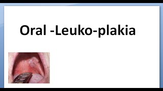 Pathology 523 a Oral Leukoplakia white plaque patch hyperkeratotic dysplastic hairy type [upl. by Leahcimnoj]