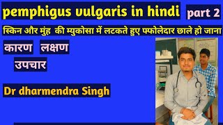 pemphigus vulgaris in hindi  pemphigus vulgaris treatment  pemphigus vulgaris symptoms  causes [upl. by Adien640]