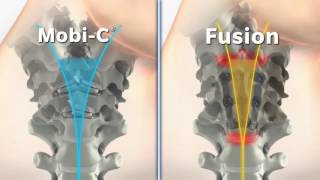 MobiC vs Fusion Animation [upl. by Woodman]