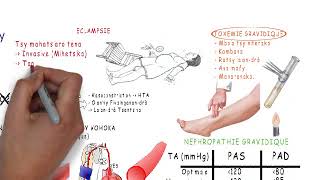 FIAKARANNY TOSIDRÀ MANDRITRA NY VOHOKA HTA GravidiqueMG   Centre de Santé MAHEFA [upl. by Ydneh]