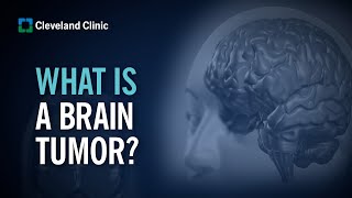 Primary Brain Tumors  What Are They and How Do They Form [upl. by Jillian]