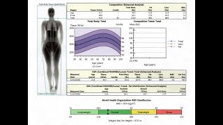 Bone Density Scanning and Results Score Analysis [upl. by Upton]