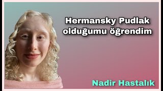 Hermansky Pudlak Sendrom Tip 1 Olduğumu Öğrendim  Hermansky Pudlak Syndrome￼ albinism HPS [upl. by Sowell]