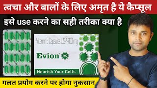 Evion 400 Uses in Hindi  Evion 400 Capsule खाने के फायदे [upl. by Aklog]