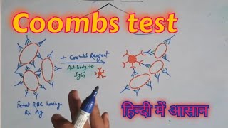 Coombs test in hindi [upl. by Fiorenze]