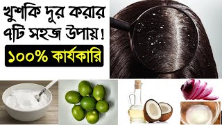 খুশকি সমস্যা চিরতরে দূর করার সহজ উপায় ৷ Khuski dur korar upay [upl. by Cornia]