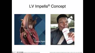 Impella What the Intensivist Needs to Know  Part 1 [upl. by Masera]