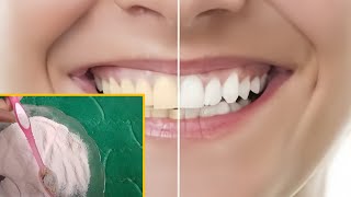 How to make teeth whitening powder at home teeth whitening powder teeth whitening Remedy [upl. by Esdnyl]