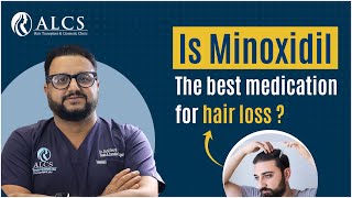 How Minoxidil Reduces Hair Loss and Strengthens Hair  ALCS Clinic with Dr Sunil Arora [upl. by Hedy]