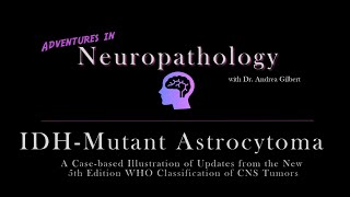 IDH  Mutant Astrocytoma Update from the 5th Edition WHO Classification of CNS Tumors [upl. by Aninad268]