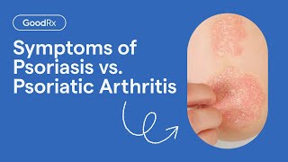 Psoriasis vs Psoriatic Arthritis Symptoms  GoodRx [upl. by Atinnod]