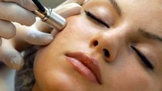 Microdermabrasion Treatments Miami Why Its So Ideal for the Skin [upl. by Adiaj]