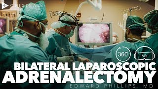 Teaching Bilateral Laparoscopic Posterior Adrenalectomy  Dr Edward H Phillips [upl. by Catie]